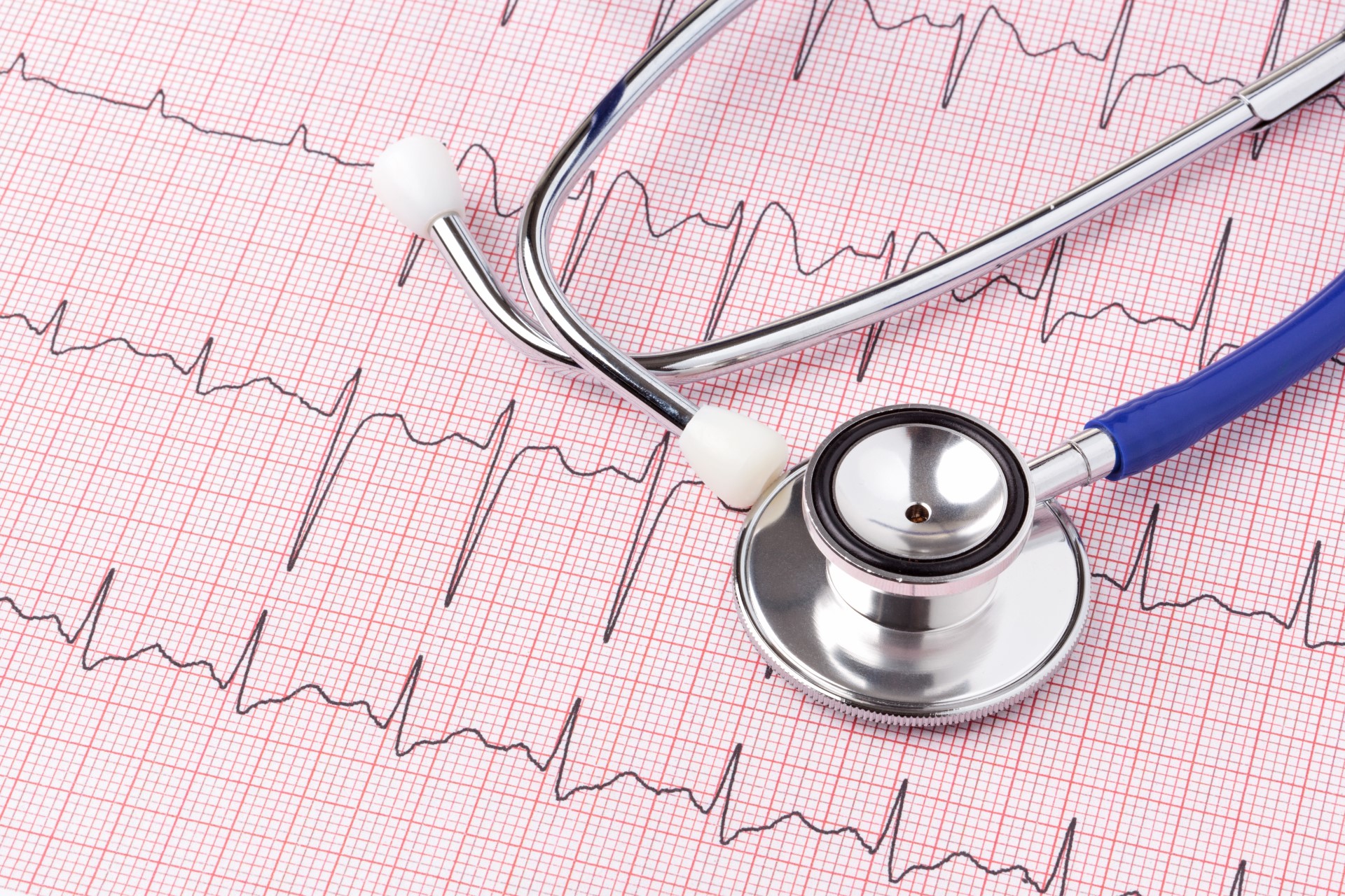 ECG graph